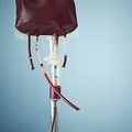Tuée par une transfusion sanguine hémolysée